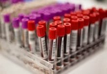 blood-plasma-corona-virus